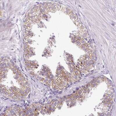 Immunohistochemistry-Paraffin: HSPC268 Antibody [NBP2-31902]