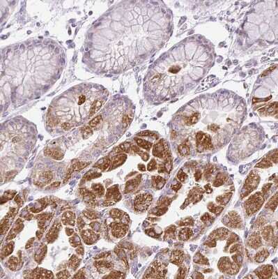Immunohistochemistry-Paraffin: HSPC268 Antibody [NBP2-31902]