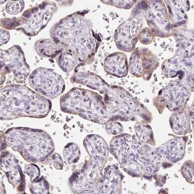 Immunohistochemistry-Paraffin: HSPC268 Antibody [NBP2-31902]