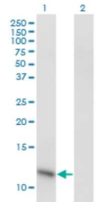 Western Blot: HSPC280 Antibody (1G12-1D7) [H00058527-M01]