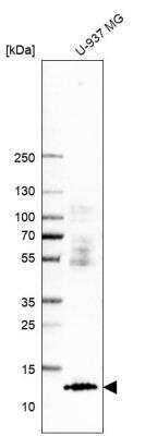 Western Blot: HSPC280 Antibody [NBP1-81670]