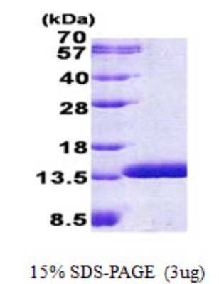 SDS-PAGE: Recombinant Human HSPC280 His Protein [NBP2-22663]