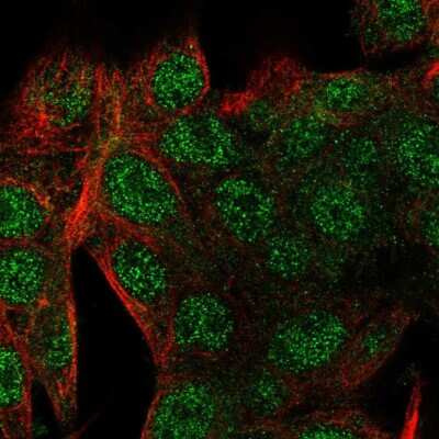 Immunocytochemistry/ Immunofluorescence: HSPC323 Antibody [NBP2-58735]