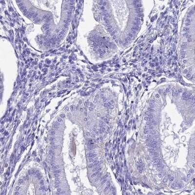 Immunohistochemistry-Paraffin: HSPC323 Antibody [NBP1-93687]