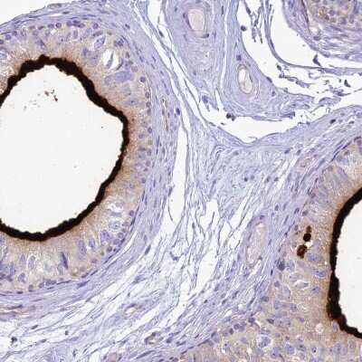 Immunohistochemistry-Paraffin: HSPC323 Antibody [NBP1-93687]