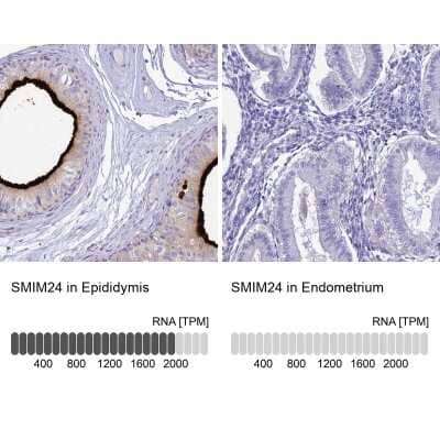 Immunohistochemistry-Paraffin: HSPC323 Antibody [NBP1-93687]