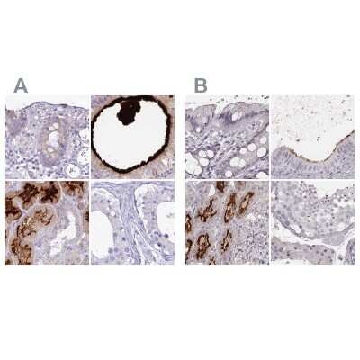 Immunohistochemistry-Paraffin: HSPC323 Antibody [NBP1-93687]