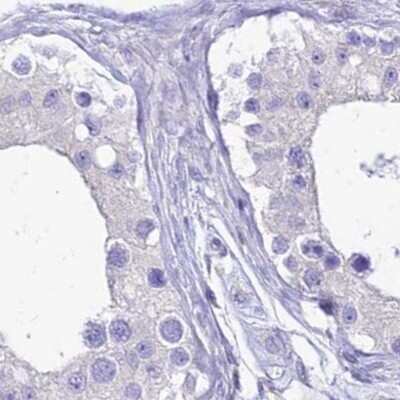 Immunohistochemistry-Paraffin: HSPC323 Antibody [NBP1-93687]