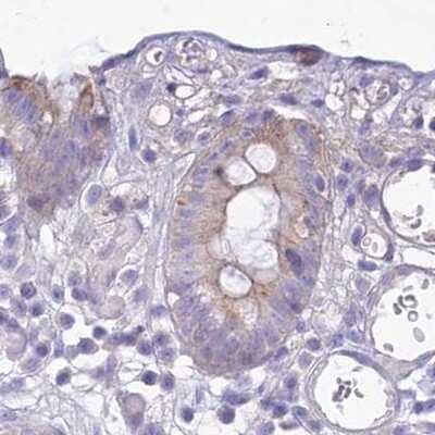 Immunohistochemistry-Paraffin: HSPC323 Antibody [NBP1-93687]