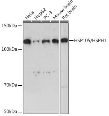 Western Blot: HSPH1/HSP105 Antibody (9Y7M10) [NBP3-16463]