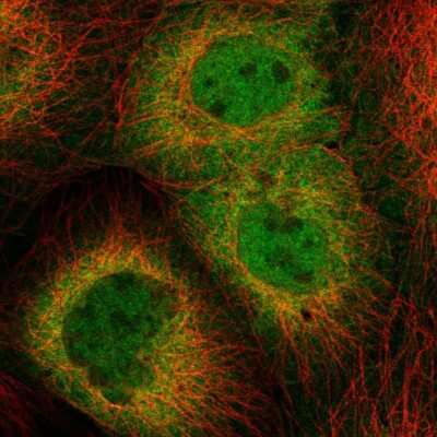 Immunocytochemistry/ Immunofluorescence: HSPH1/HSP105 Antibody [NBP2-55047]