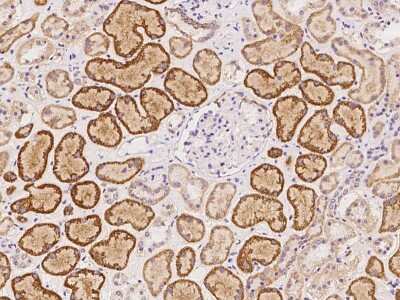 Immunohistochemistry-Paraffin: HSPH1/HSP105 Antibody [NBP2-97291]