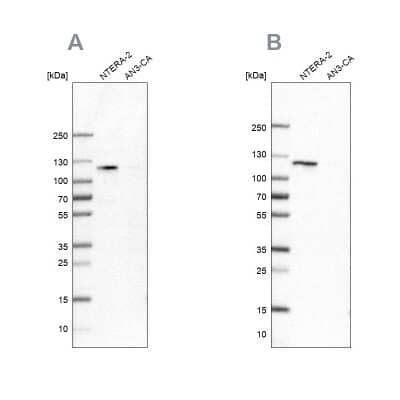 Western Blot: HSPH1/HSP105 Antibody [NBP2-55047]