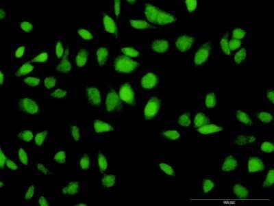 Immunocytochemistry/ Immunofluorescence: HSU79274 Antibody [H00029902-D01P]