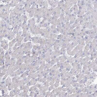Immunohistochemistry-Paraffin: HSU79274 Antibody [NBP2-47425]