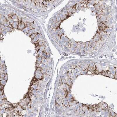 Immunohistochemistry-Paraffin: HSU79274 Antibody [NBP2-47425]