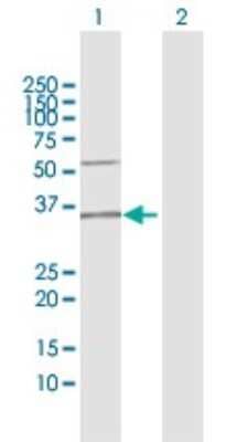 Western Blot: HSU79274 Antibody [H00029902-D01P]