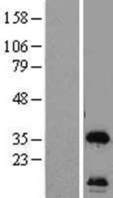 Western Blot: HSU79274 Overexpression Lysate [NBL1-08130]