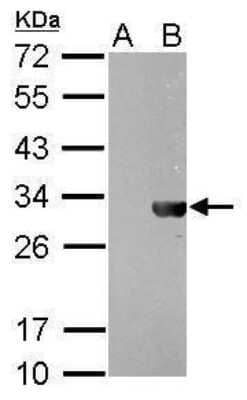 Western Blot: HSV Tag Antibody (212) [NBP2-43734]