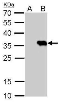 Western Blot: HSV Tag Antibody (223) [NBP2-43816]