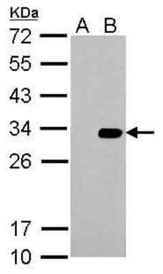 Western Blot: HSV Tag Antibody [NBP2-43815]