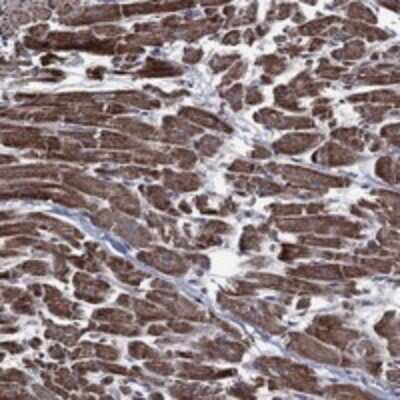 Immunohistochemistry-Paraffin: HTD2 Antibody [NBP3-17969]