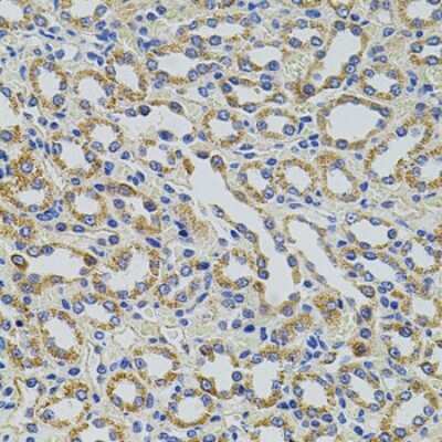 Immunohistochemistry-Paraffin: HTF9C Antibody - BSA Free [NBP3-02999]