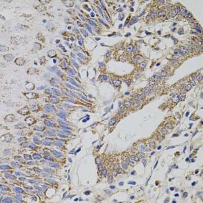 Immunohistochemistry-Paraffin: HTF9C Antibody - BSA Free [NBP3-02999]