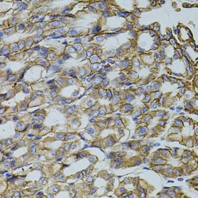 Immunohistochemistry-Paraffin: HTF9C Antibody - BSA Free [NBP3-02999]
