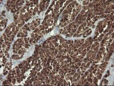 Immunohistochemistry: HTF9C Antibody (OTI1C3) - Azide and BSA Free [NBP2-71830]