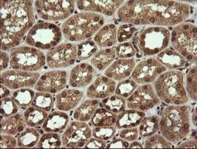 Immunohistochemistry: HTF9C Antibody (OTI1C3) - Azide and BSA Free [NBP2-71830]