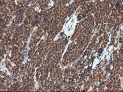 Immunohistochemistry: HTF9C Antibody (OTI1C3) - Azide and BSA Free [NBP2-71830]