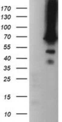 Western Blot: HTF9C Antibody (OTI1C3)Azide and BSA Free [NBP2-71830]