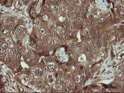 Immunohistochemistry: HTF9C Antibody (OTI1C3) [NBP2-46015]
