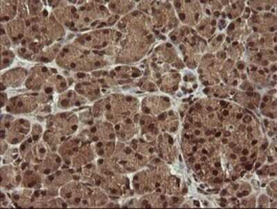 Immunohistochemistry: HTF9C Antibody (OTI1C3) [NBP2-46015]