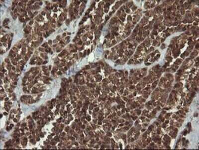 Immunohistochemistry: HTF9C Antibody (OTI1C3) [NBP2-46015]