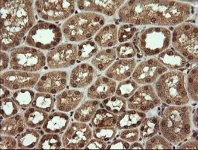 Immunohistochemistry: HTF9C Antibody (OTI1C3) [NBP2-46015]