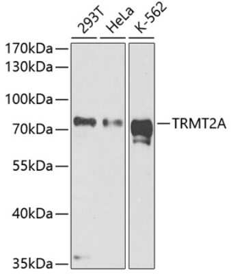 Western Blot: HTF9C AntibodyBSA Free [NBP3-02999]