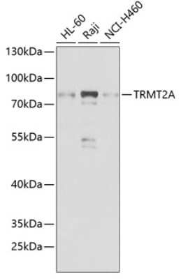 Western Blot: HTF9C AntibodyBSA Free [NBP3-03398]