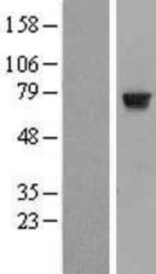 Western Blot: HTF9C Overexpression Lysate [NBL1-11772]