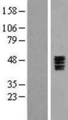 Western Blot: 5-HT3C Overexpression Lysate [NBP2-05732]