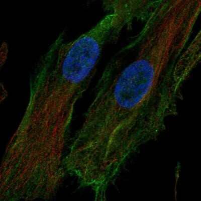 Immunocytochemistry/ Immunofluorescence: HTRA1/PRSS11 Antibody [NBP1-81654]