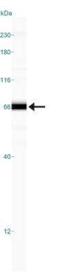 Simple Western: HTRA1/PRSS11 Antibody [NBP2-23869]