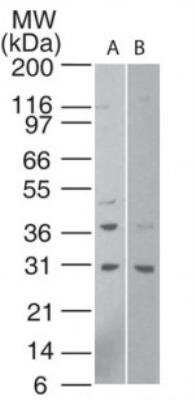 Western Blot: HTRA1/PRSS11 Antibody [NBP2-23869]