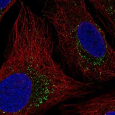 Immunocytochemistry/ Immunofluorescence: HTRA2/Omi Antibody [NBP2-58890]