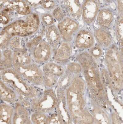Immunohistochemistry-Paraffin: HTRA2/Omi Antibody [NBP1-82482]