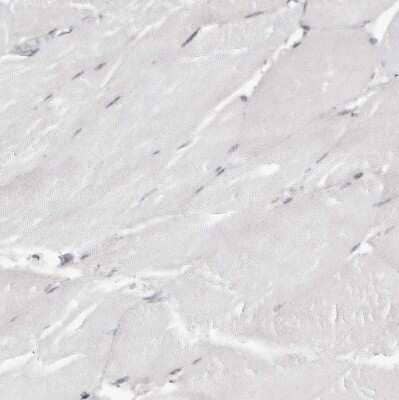 Immunohistochemistry-Paraffin: HTRA2/Omi Antibody [NBP1-82482]