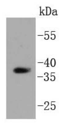 Western Blot: HTRA2/Omi Antibody (ST54-05) [NBP2-67543]