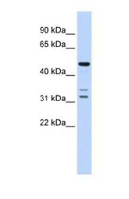 Western Blot: htrA4 Antibody [NBP1-69684]