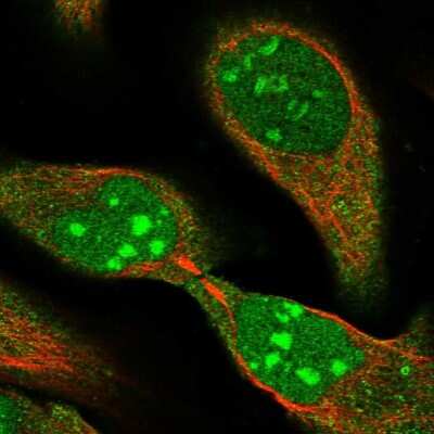 Immunocytochemistry/ Immunofluorescence: HUCE1 Antibody [NBP1-89618]